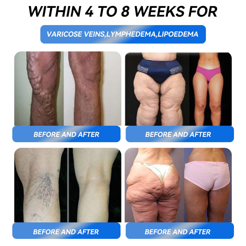 IFMAGIC® GLP-1 Pro Weight Loss Oral Solution✅One dose a day — see results in 7 days👩⚕️Suitable for obesity, cardiovascular diseases, diabetes, sleep apnea, high cholesterol and blood lipids, joint problems, and various other conditions🌺