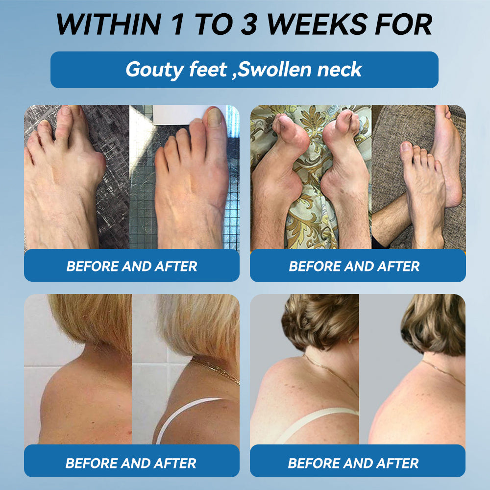𝖯𝗂𝖼𝗱𝗼® BPC-157 Joint Healing Cream🦴Treats Arthritis, Neuropathy, Rheumatism, Sports Injuries & More💪