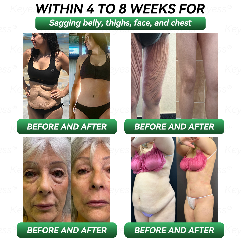 𝐎𝐟𝐟𝐢𝐜𝐢𝐚𝐥 𝐒𝐭𝐨𝐫𝐞 | 𝐊𝐞𝐲𝐞𝐬𝐬® 𝐆𝐋𝐏-𝟏 & 𝐌𝐚𝐭𝐫𝐢𝐱𝐲𝐥 𝟑𝟎𝟎𝟎 𝐒𝐥𝐢𝐦𝐦𝐢𝐧𝐠 & 𝐇𝐞𝐚𝐥𝐭𝐡 𝐃𝐫𝐨𝐩𝐬(𝐉𝐮𝐬𝐭 𝐨𝐧𝐞 𝐝𝐨𝐬𝐞 𝐚 𝐝𝐚𝐲 — 𝐯𝐢𝐬𝐢𝐛𝐥𝐞 𝐫𝐞𝐬𝐮𝐥𝐭𝐬 𝐢𝐧 𝐣𝐮𝐬𝐭 𝟕 𝐝𝐚𝐲𝐬)✅ 𝐅𝐨𝐫 𝐨𝐛𝐞𝐬𝐢𝐭𝐲, 𝐜𝐚𝐫𝐝𝐢𝐨𝐯𝐚𝐬𝐜𝐮𝐥𝐚𝐫 𝐡𝐞𝐚𝐥𝐭𝐡, 𝐝𝐢𝐚𝐛𝐞𝐭𝐞𝐬, 𝐬𝐥𝐞𝐞𝐩 𝐚𝐩𝐧𝐞𝐚, 𝐣𝐨𝐢𝐧𝐭 𝐢𝐬𝐬𝐮𝐞𝐬, 𝐚𝐧𝐝 𝐦𝐨𝐫𝐞💎