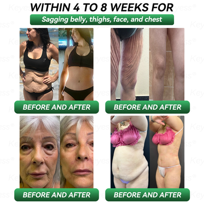 𝐎𝐟𝐟𝐢𝐜𝐢𝐚𝐥 𝐒𝐭𝐨𝐫𝐞 | 𝐊𝐞𝐲𝐞𝐬𝐬® 𝐆𝐋𝐏-𝟏 & 𝐌𝐚𝐭𝐫𝐢𝐱𝐲𝐥 𝟑𝟎𝟎𝟎 𝐒𝐥𝐢𝐦𝐦𝐢𝐧𝐠 & 𝐇𝐞𝐚𝐥𝐭𝐡 𝐃𝐫𝐨𝐩𝐬(𝐉𝐮𝐬𝐭 𝐨𝐧𝐞 𝐝𝐨𝐬𝐞 𝐚 𝐝𝐚𝐲 — 𝐯𝐢𝐬𝐢𝐛𝐥𝐞 𝐫𝐞𝐬𝐮𝐥𝐭𝐬 𝐢𝐧 𝐣𝐮𝐬𝐭 𝟕 𝐝𝐚𝐲𝐬)✅ 𝐅𝐨𝐫 𝐨𝐛𝐞𝐬𝐢𝐭𝐲, 𝐜𝐚𝐫𝐝𝐢𝐨𝐯𝐚𝐬𝐜𝐮𝐥𝐚𝐫 𝐡𝐞𝐚𝐥𝐭𝐡, 𝐝𝐢𝐚𝐛𝐞𝐭𝐞𝐬, 𝐬𝐥𝐞𝐞𝐩 𝐚𝐩𝐧𝐞𝐚, 𝐣𝐨𝐢𝐧𝐭 𝐢𝐬𝐬𝐮𝐞𝐬, 𝐚𝐧𝐝 𝐦𝐨𝐫𝐞💎