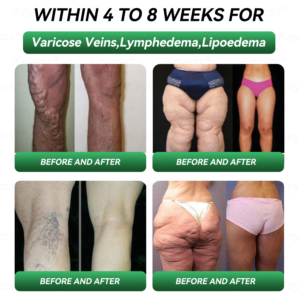 𝐎𝐟𝐟𝐢𝐜𝐢𝐚𝐥 𝐒𝐭𝐨𝐫𝐞 | 𝐊𝐞𝐲𝐞𝐬𝐬® 𝐆𝐋𝐏-𝟏 & 𝐌𝐚𝐭𝐫𝐢𝐱𝐲𝐥 𝟑𝟎𝟎𝟎 𝐒𝐥𝐢𝐦𝐦𝐢𝐧𝐠 & 𝐇𝐞𝐚𝐥𝐭𝐡 𝐃𝐫𝐨𝐩𝐬(𝐉𝐮𝐬𝐭 𝐨𝐧𝐞 𝐝𝐨𝐬𝐞 𝐚 𝐝𝐚𝐲 — 𝐯𝐢𝐬𝐢𝐛𝐥𝐞 𝐫𝐞𝐬𝐮𝐥𝐭𝐬 𝐢𝐧 𝐣𝐮𝐬𝐭 𝟕 𝐝𝐚𝐲𝐬)✅ 𝐅𝐨𝐫 𝐨𝐛𝐞𝐬𝐢𝐭𝐲, 𝐜𝐚𝐫𝐝𝐢𝐨𝐯𝐚𝐬𝐜𝐮𝐥𝐚𝐫 𝐡𝐞𝐚𝐥𝐭𝐡, 𝐝𝐢𝐚𝐛𝐞𝐭𝐞𝐬, 𝐬𝐥𝐞𝐞𝐩 𝐚𝐩𝐧𝐞𝐚, 𝐣𝐨𝐢𝐧𝐭 𝐢𝐬𝐬𝐮𝐞𝐬, 𝐚𝐧𝐝 𝐦𝐨𝐫𝐞💎