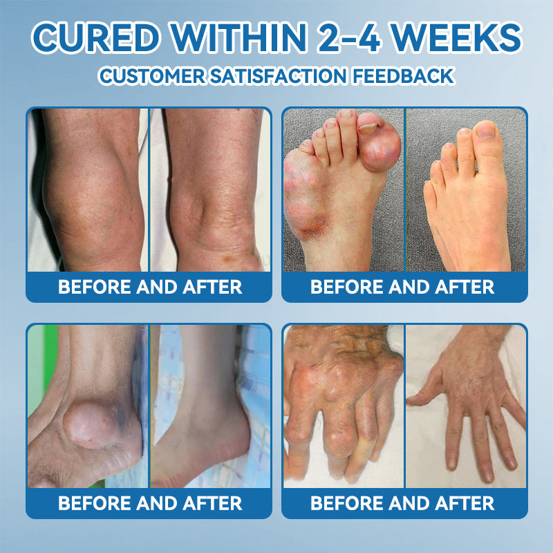 𝖯𝗂𝖼𝗱𝗼® BPC-157 Joint Healing Cream🦴Treats Arthritis, Neuropathy, Rheumatism, Sports Injuries & More💪