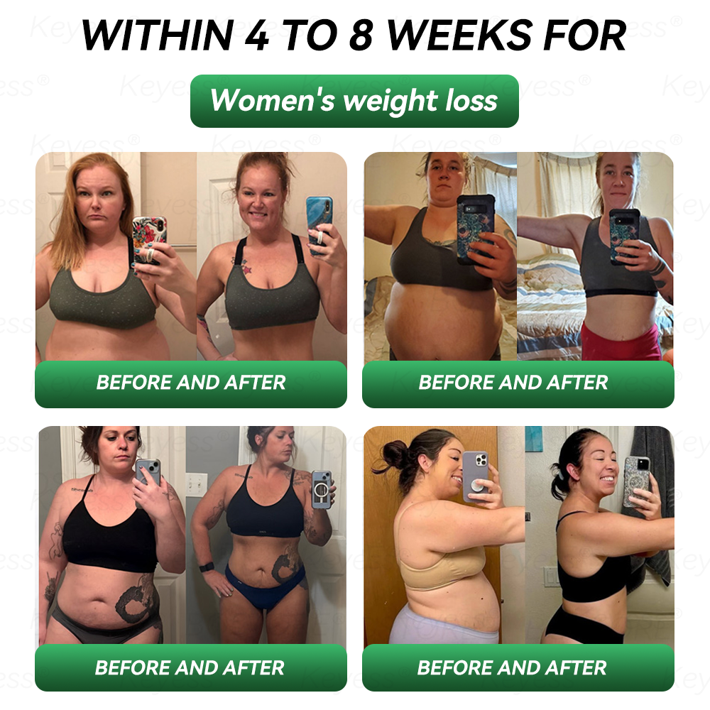 𝐎𝐟𝐟𝐢𝐜𝐢𝐚𝐥 𝐒𝐭𝐨𝐫𝐞 | 𝐊𝐞𝐲𝐞𝐬𝐬® 𝐆𝐋𝐏-𝟏 & 𝐌𝐚𝐭𝐫𝐢𝐱𝐲𝐥 𝟑𝟎𝟎𝟎 𝐒𝐥𝐢𝐦𝐦𝐢𝐧𝐠 & 𝐇𝐞𝐚𝐥𝐭𝐡 𝐃𝐫𝐨𝐩𝐬(𝐉𝐮𝐬𝐭 𝐨𝐧𝐞 𝐝𝐨𝐬𝐞 𝐚 𝐝𝐚𝐲 — 𝐯𝐢𝐬𝐢𝐛𝐥𝐞 𝐫𝐞𝐬𝐮𝐥𝐭𝐬 𝐢𝐧 𝐣𝐮𝐬𝐭 𝟕 𝐝𝐚𝐲𝐬)✅ 𝐅𝐨𝐫 𝐨𝐛𝐞𝐬𝐢𝐭𝐲, 𝐜𝐚𝐫𝐝𝐢𝐨𝐯𝐚𝐬𝐜𝐮𝐥𝐚𝐫 𝐡𝐞𝐚𝐥𝐭𝐡, 𝐝𝐢𝐚𝐛𝐞𝐭𝐞𝐬, 𝐬𝐥𝐞𝐞𝐩 𝐚𝐩𝐧𝐞𝐚, 𝐣𝐨𝐢𝐧𝐭 𝐢𝐬𝐬𝐮𝐞𝐬, 𝐚𝐧𝐝 𝐦𝐨𝐫𝐞💎