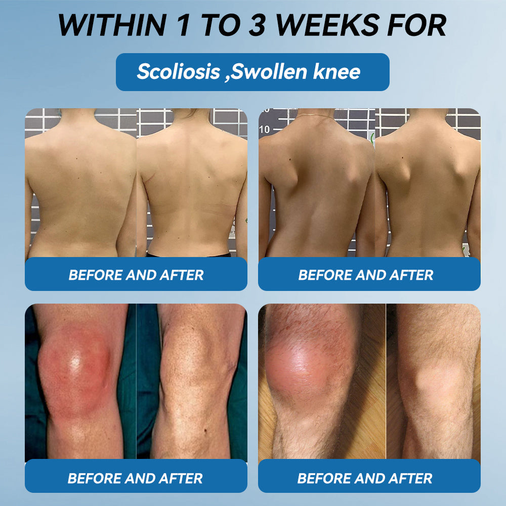 𝖯𝗂𝖼𝗱𝗼® BPC-157 Joint Healing Cream🦴Treats Arthritis, Neuropathy, Rheumatism, Sports Injuries & More💪