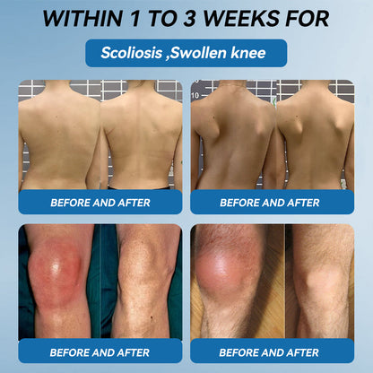 𝖯𝗂𝖼𝗱𝗼® BPC-157 Joint Healing Cream🦴Treats Arthritis, Neuropathy, Rheumatism, Sports Injuries & More💪