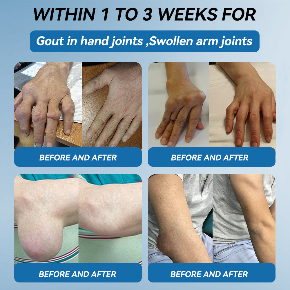 𝖯𝗂𝖼𝗱𝗼® BPC-157 Joint Healing Cream🦴Treats Arthritis, Neuropathy, Rheumatism, Sports Injuries & More💪